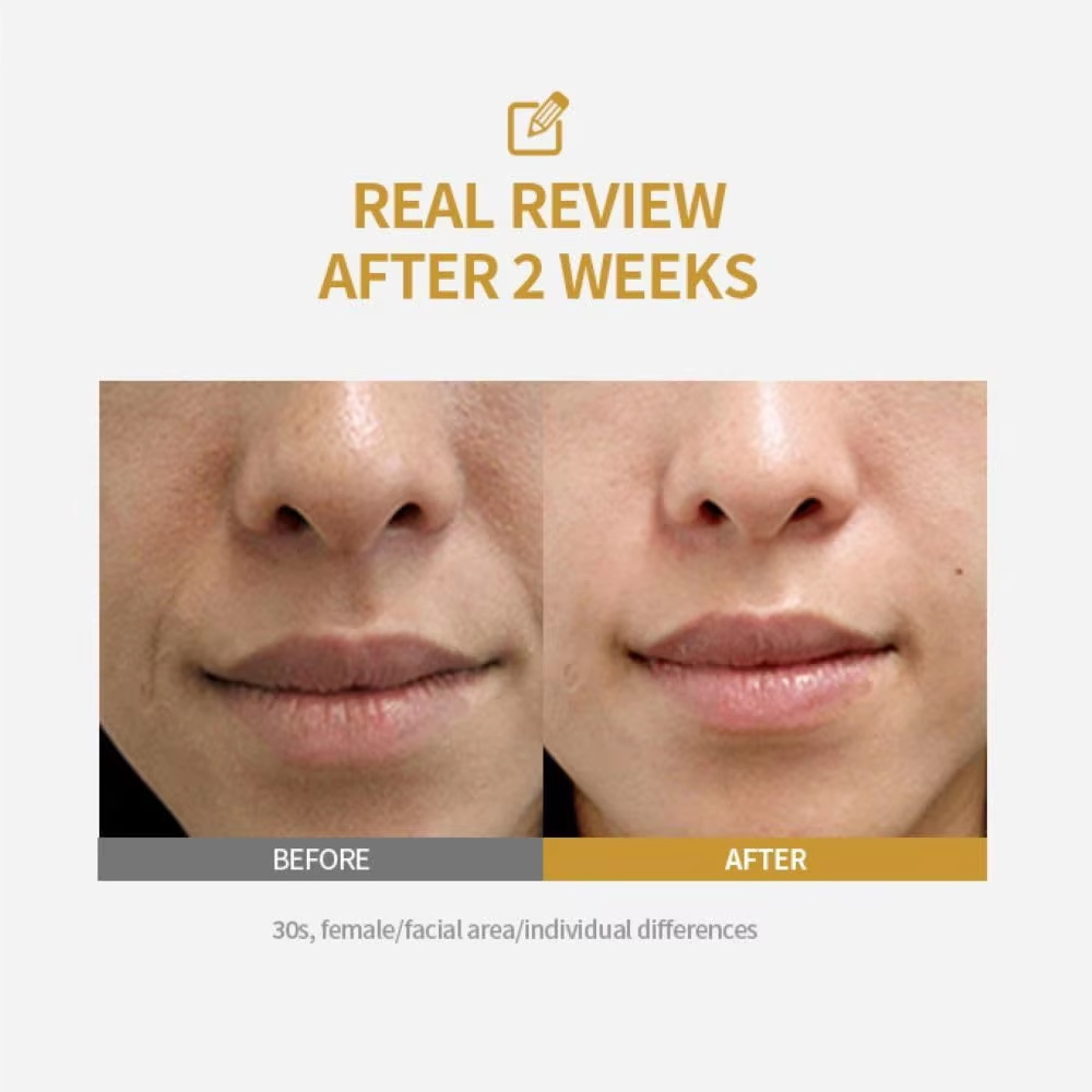 펩타이드 인텐시브 리프팅 앰플, 딥 콜라겐 페이스 퍼밍 - Collagen Peptide Powder 리뷰 및 가격